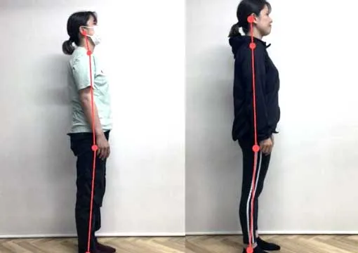 fit.姿勢改善ビフォーアフター